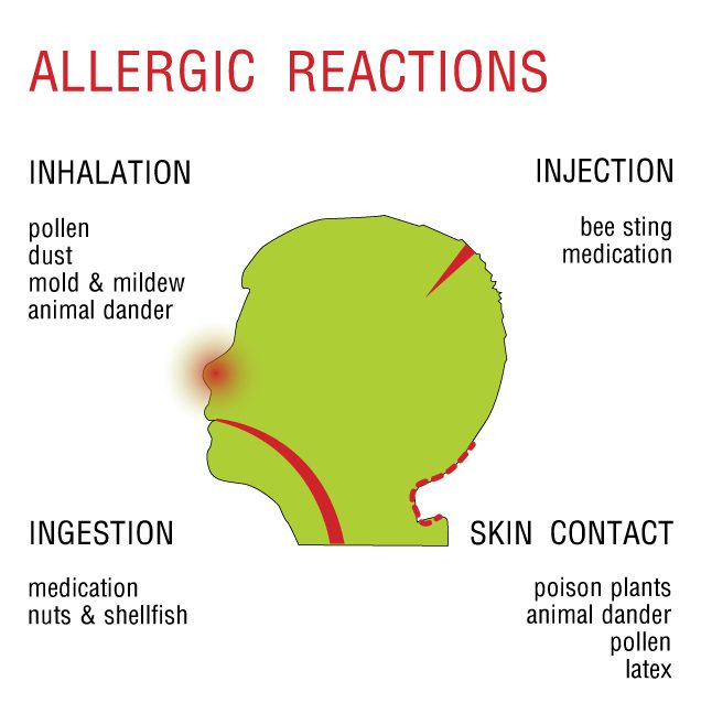 allergy reaction